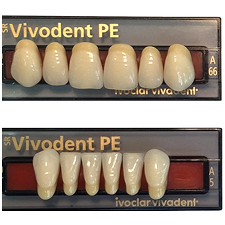 SR Vivodent PE Shade 110/01, A9 Lower Anterior